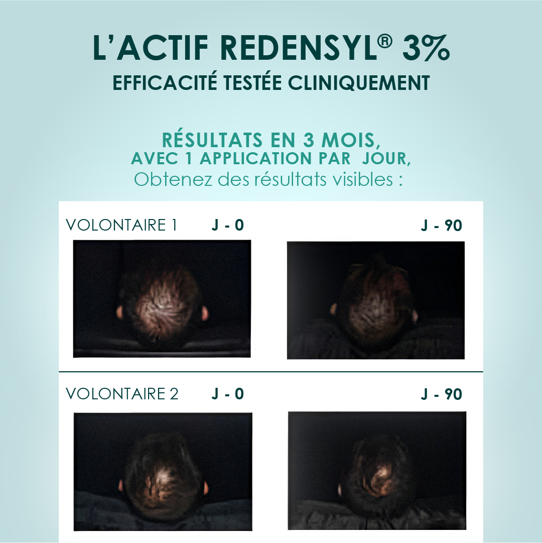 Sérum Volume & Croissance Redensyl® 3%